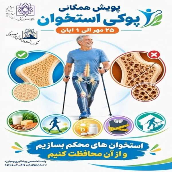 پویش همگانی پوکی استخوان 25 مهر الی 1 آبان